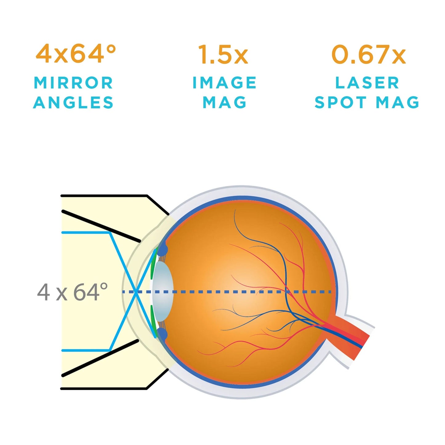 Volk G-4 Gonio Lens High Mag No Flange - Large Ring (VG4HMLNF)