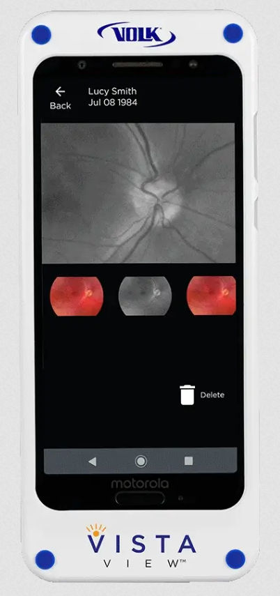 Volk Vista View VVISTAVIEW