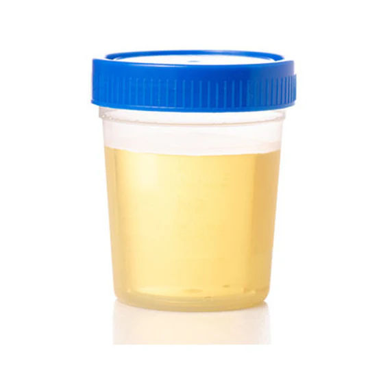 Cruzine Urine Culture Bottle Plastic Non Sterile - 100ml Pack of 50