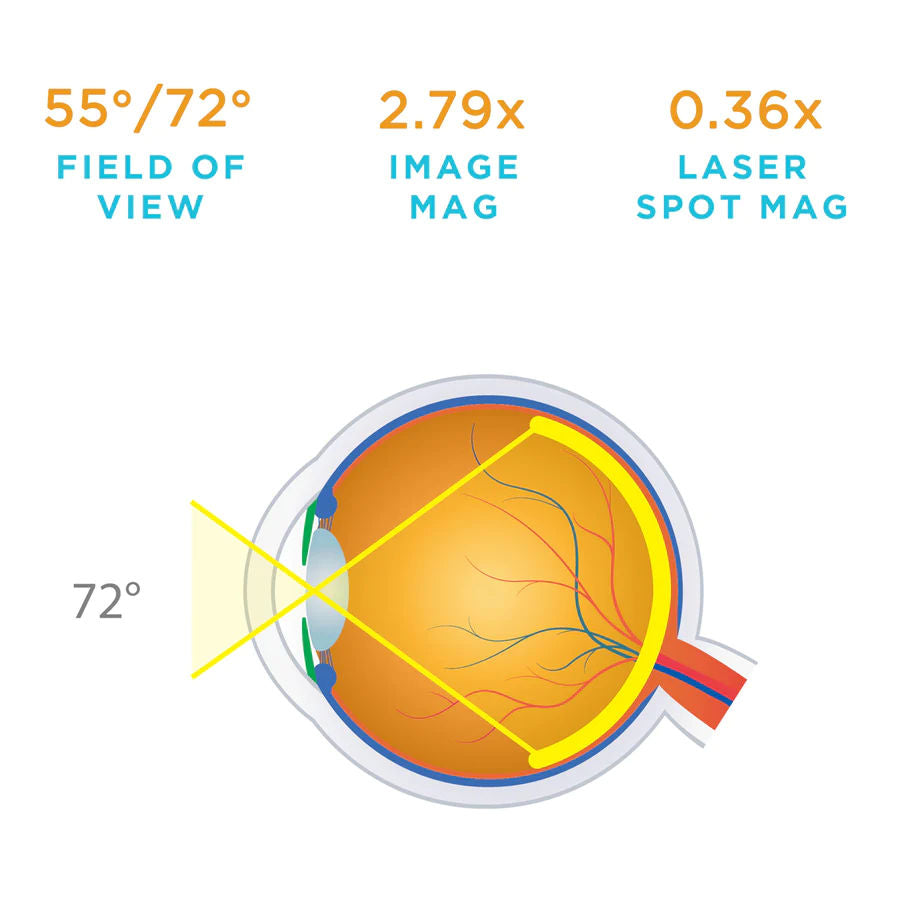 Volk Digital Clear Field Bio Lens - Blue Ring (VDGTLCF)
