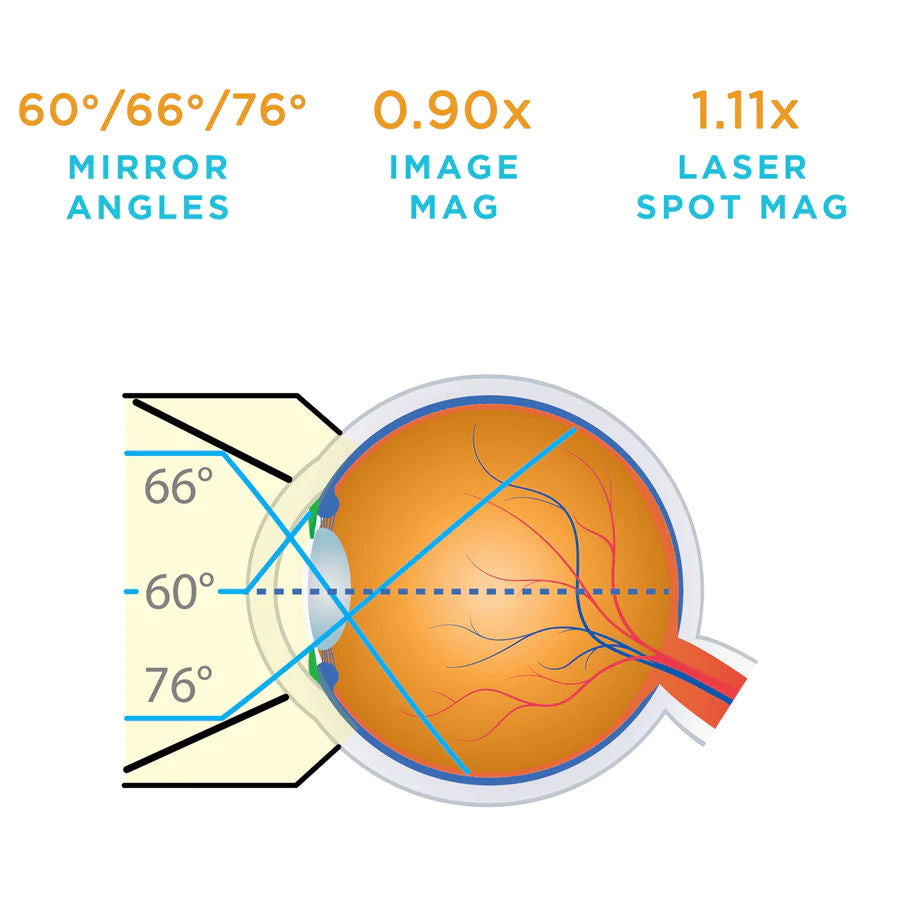 Volk Acrylic Mirrored Lens - 3-Mirror No Flange Uncoated - Diagnostic/Laser (VU3MIR)