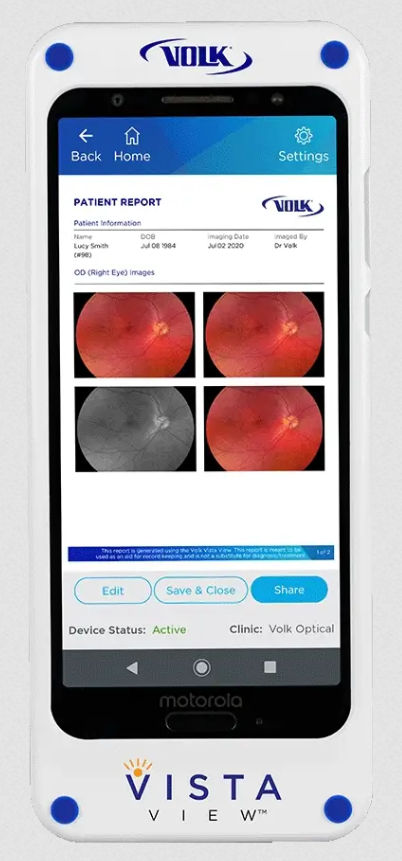 Volk Vista View VVISTAVIEW