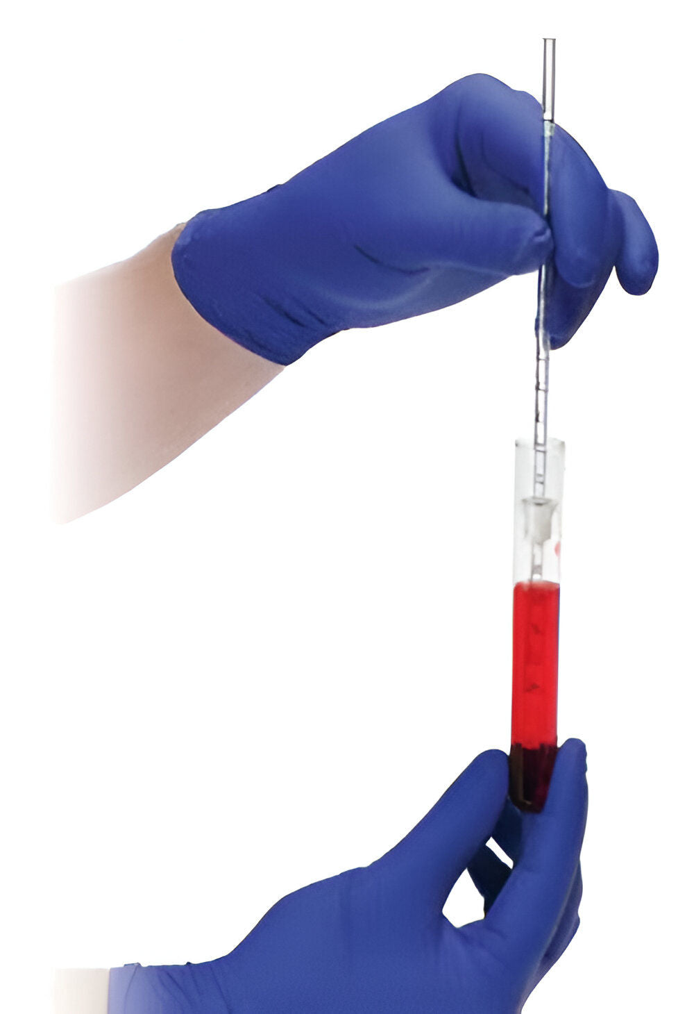 Fusion Biotech Disposable ESR Pipette - Pack of 100 Pipettes (FB-7033)